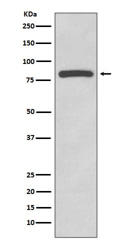 Anti-Glycogen synthase GYS1 Rabbit Monoclonal Antibody Boster Bio