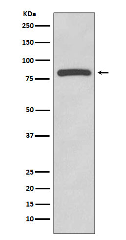 Anti-Glycogen synthase GYS1 Rabbit Monoclonal Antibody Boster Bio