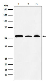 Anti-NONO / p54nrb Rabbit Monoclonal Antibody Boster Bio