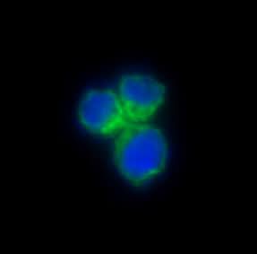 Anti-CCR8 Rabbit Monoclonal Antibody Boster Bio