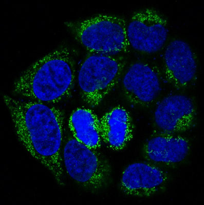 Anti-Bad Rabbit Monoclonal Antibody Boster Bio