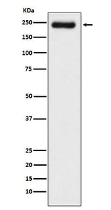 Anti-Laminin gamma 1 Rabbit Monoclonal Antibody Boster Bio