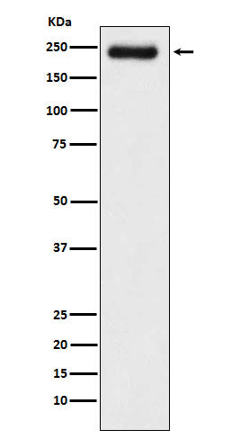 Anti-Laminin gamma 1 Rabbit Monoclonal Antibody Boster Bio