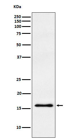 Anti-gamma Synuclein Rabbit Monoclonal Antibody Boster Bio