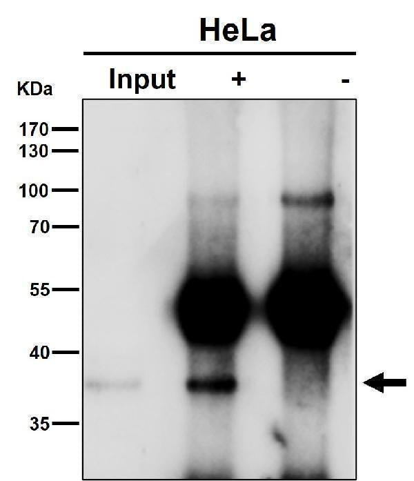 Anti-NFYA Rabbit Monoclonal Antibody Boster Bio