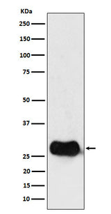 Anti-HLA DMB Rabbit Monoclonal Antibody Boster Bio