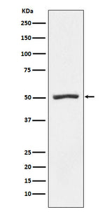 Anti-PSMD4 Rabbit Monoclonal Antibody Boster Bio