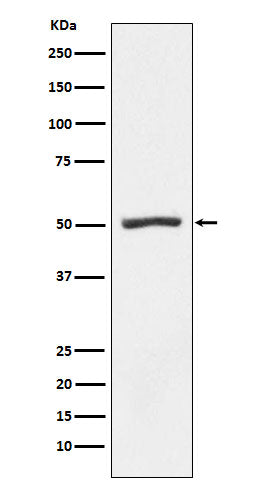 Anti-PSMD4 Rabbit Monoclonal Antibody Boster Bio
