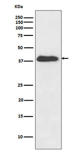 Anti-XLF Rabbit Monoclonal Antibody Boster Bio