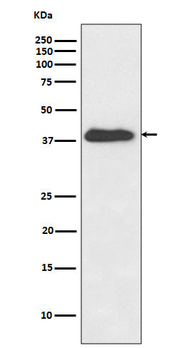 Anti-XLF Rabbit Monoclonal Antibody Boster Bio