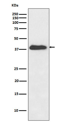 Anti-XLF Rabbit Monoclonal Antibody Boster Bio