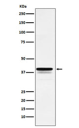 Anti-FOXF1 Rabbit Monoclonal Antibody Boster Bio