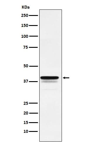 Anti-FOXF1 Rabbit Monoclonal Antibody Boster Bio