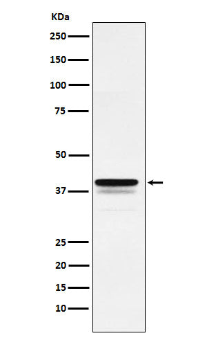 Anti-FOXF1 Rabbit Monoclonal Antibody Boster Bio
