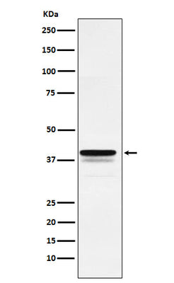 Anti-FOXF1 Rabbit Monoclonal Antibody Boster Bio