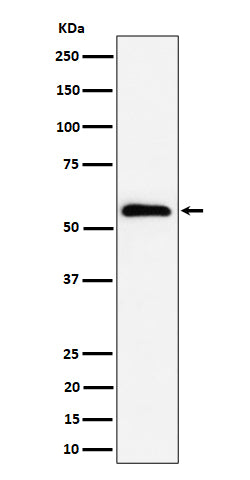 Anti-PNK / PNKP Rabbit Monoclonal Antibody Boster Bio