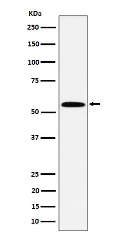 Anti-PNK / PNKP Rabbit Monoclonal Antibody Boster Bio