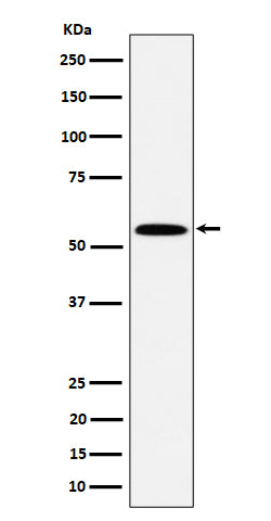 Anti-PNK / PNKP Rabbit Monoclonal Antibody Boster Bio