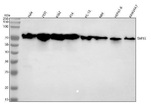 Anti-TAF15 Rabbit Monoclonal Antibody Boster Bio
