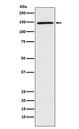 Anti-PLCG2 Rabbit Monoclonal Antibody Boster Bio