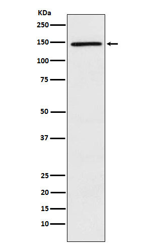 Anti-PLCG2 Rabbit Monoclonal Antibody Boster Bio