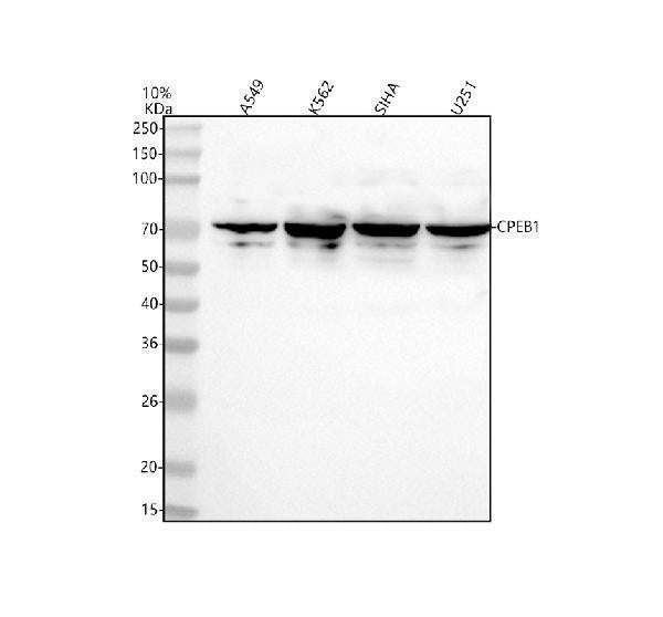 Anti-CPEB1 Rabbit Monoclonal Antibody Boster Bio