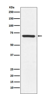 Anti-MEKK3 MAP3K3 Rabbit Monoclonal Antibody Boster Bio