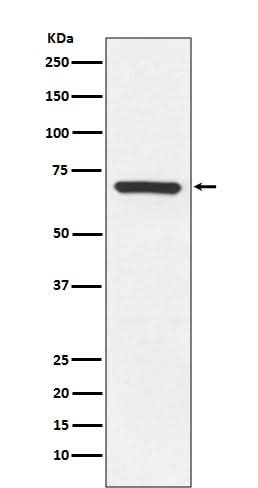 Anti-MEKK3 MAP3K3 Rabbit Monoclonal Antibody Boster Bio