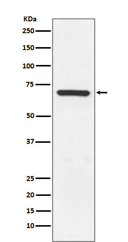 Anti-MEKK3 MAP3K3 Rabbit Monoclonal Antibody Boster Bio