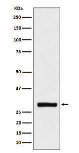 Anti-BRMS1 Rabbit Monoclonal Antibody Boster Bio