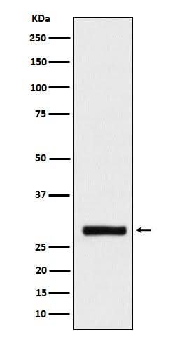 Anti-BRMS1 Rabbit Monoclonal Antibody Boster Bio