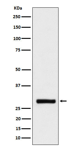 Anti-BRMS1 Rabbit Monoclonal Antibody Boster Bio