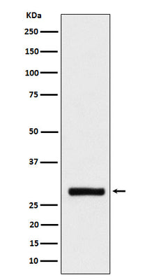 Anti-BRMS1 Rabbit Monoclonal Antibody Boster Bio