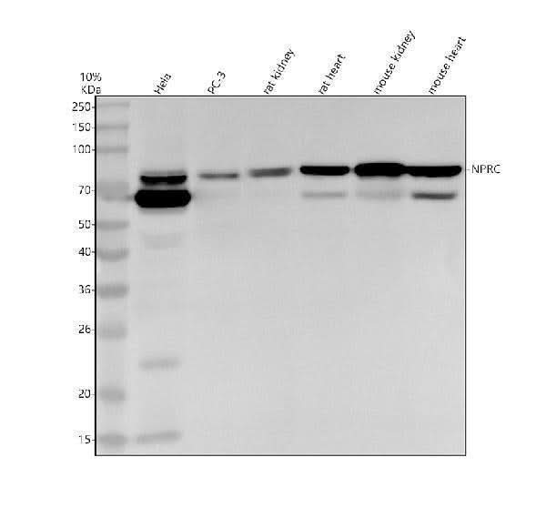 Anti-NPRC Rabbit Monoclonal Antibody Boster Bio
