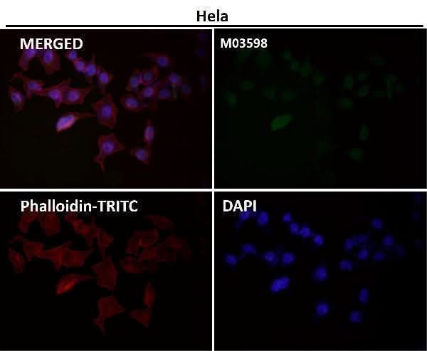 Anti-ATP5A1/Atp5A Rabbit Monoclonal Antibody Boster Bio