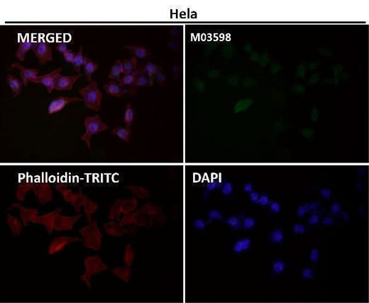 Anti-ATP5A1/Atp5A Rabbit Monoclonal Antibody Boster Bio