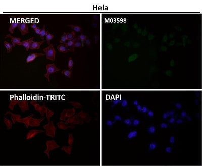 Anti-ATP5A1/Atp5A Rabbit Monoclonal Antibody Boster Bio