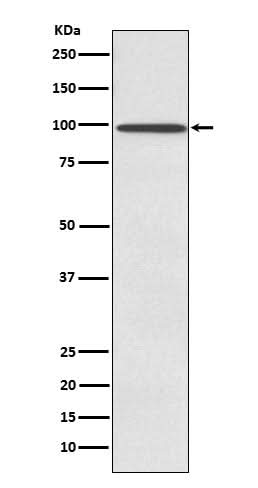 Anti-SUN1 Rabbit Monoclonal Antibody Boster Bio