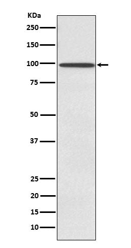Anti-SUN1 Rabbit Monoclonal Antibody Boster Bio