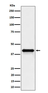 Anti-Wnt16 Rabbit Monoclonal Antibody Boster Bio
