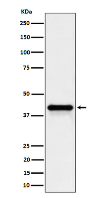 Anti-Wnt16 Rabbit Monoclonal Antibody Boster Bio