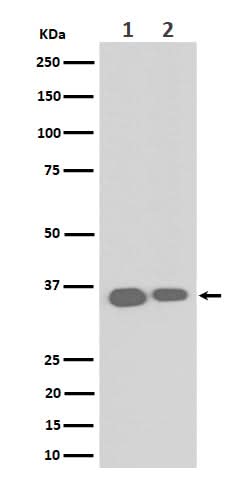 Anti-ELOVL5 Rabbit Monoclonal Antibody Boster Bio