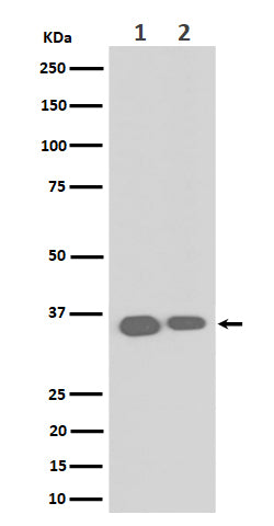Anti-ELOVL5 Rabbit Monoclonal Antibody Boster Bio