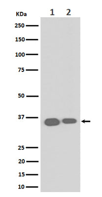 Anti-ELOVL5 Rabbit Monoclonal Antibody Boster Bio