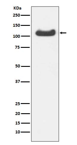 Anti-HSPA4 Rabbit Monoclonal Antibody Boster Bio