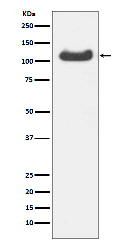 Anti-HSPA4 Rabbit Monoclonal Antibody Boster Bio