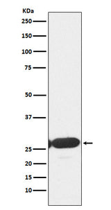 Anti-ERp29 Rabbit Monoclonal Antibody Boster Bio