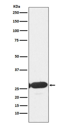 Anti-ERp29 Rabbit Monoclonal Antibody Boster Bio