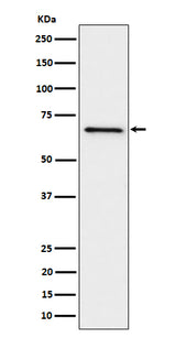 Anti-GRK6 Rabbit Monoclonal Antibody Boster Bio