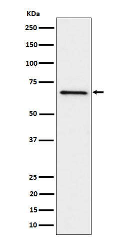 Anti-GRK6 Rabbit Monoclonal Antibody Boster Bio